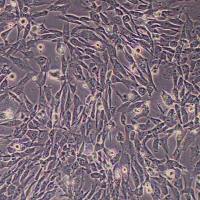 HAVSMC-SV40T主动脉平滑肌细胞永生化_HAVSMC-SV40T细胞(STR鉴定)