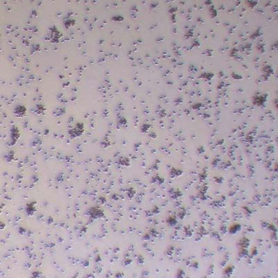 Mo7e人巨细胞白血病细胞株_Mo7e细胞(STR鉴定)