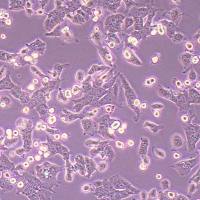 WSU-HN30人口腔鳞状癌细胞_WSU-HN30细胞(STR鉴定)