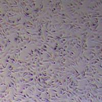 HCC2279人肺癌细胞(混合)_HCC2279细胞(STR鉴定)