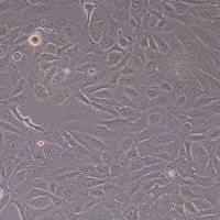 人Ⅱ型肺泡上皮细胞永生化_人Ⅱ型肺泡上皮细胞永生化细胞(STR鉴定)