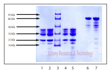 Athens代理-血管舒缓素，人血浆，让实验更高效
