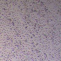 LCC人喉癌细胞_LCC细胞(STR鉴定)