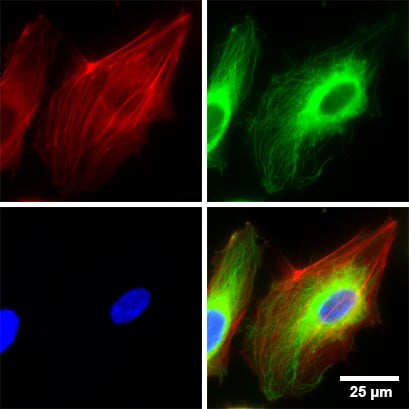 IBIDI 易必迪 8 孔高壁腔室载玻片,ibiTreat