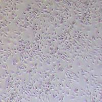 HSC-2人口底癌细胞_HSC-2细胞(STR鉴定)