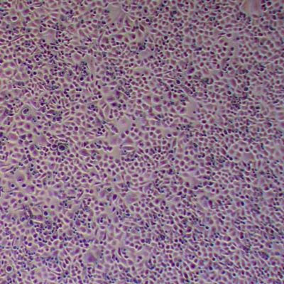 CC-LP-1 人肝内胆管癌细胞_CC-LP-1 细胞(STR鉴定)