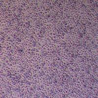 CC-LP-1 人肝内胆管癌细胞_CC-LP-1 细胞(STR鉴定)