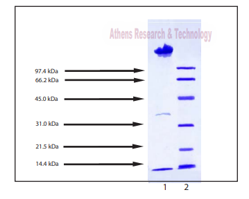 Athens代理-脂蛋白，中等密度，人血浆：击穿底价