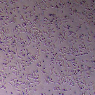 CHL-1人黑色素瘤细胞_CHL-1细胞(STR鉴定)