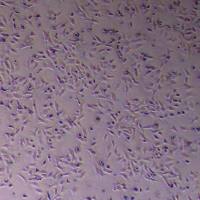 CHL-1人黑色素瘤细胞_CHL-1细胞(STR鉴定)