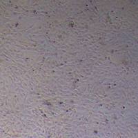 HBVP-SV40T-hTERT人脑血管周细胞永生化_HBVP-SV40T-hTERT细胞