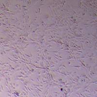 sNF96.2人雪旺细胞永生化/施万细胞_sNF96.2细胞(STR鉴定)