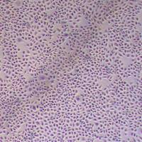 HCC1806人乳腺鳞状癌细胞(三阴性)_HCC1806细胞(STR鉴定)