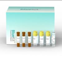 Human残留DNA检测试剂盒 (qPCR-荧光探针法)