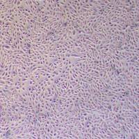 NCI-H1666人肺支气管癌细胞_NCI-H1666细胞(STR鉴定)