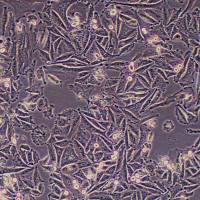 SNU-668 人胃癌细胞_SNU-668 细胞(STR鉴定)