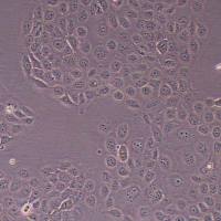 WSU-HN6 人舌鳞癌细胞_WSU-HN6 细胞(STR鉴定)