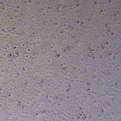 MH7A关节炎成纤维细胞_MH7A细胞(STR鉴定)