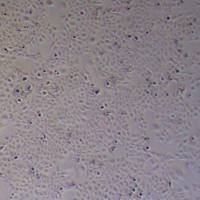 MH7A关节炎成纤维细胞_MH7A细胞(STR鉴定)