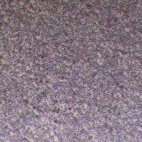 SKNO-1人急性髓系白血病细胞_SKNO-1细胞(STR鉴定)