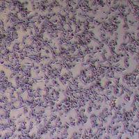 C4-2B人前列腺细胞_C4-2B细胞(STR鉴定)