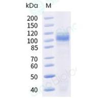 Recombinant Cynomolgus Cadherin-17 Protein (His Tag), HPLC-verified (义翘神州 90994-C08H 现货特卖)