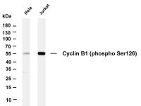 Cyclin B1 (Phospho Ser126) (PT0070R) PT® Rabbit mAb