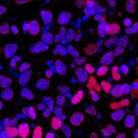 hPSC来源中脑多巴胺神经元祖细胞imDAP-H1