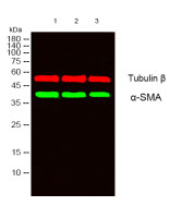 α smooth muscle actin (PT0074R) PT® Rabbit mAb