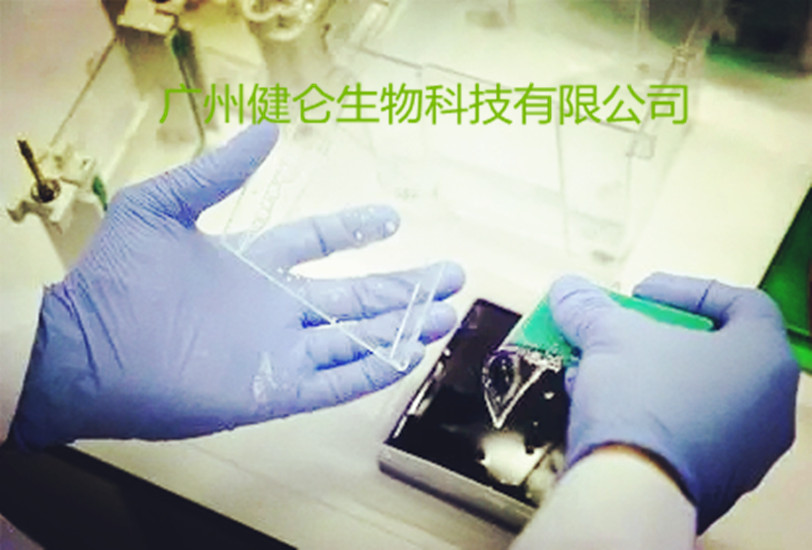 CAGTA侵袭性念珠真菌病IgG IFA检测试剂盒（荧光法）