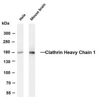 Tuberin (PT0374R) PT® Rabbit mAb