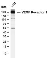 VEGF Receptor 1 (PT0056R) PT® Rabbit mAb