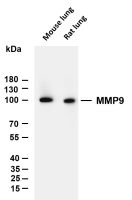 Ezrin (PT0732R) PT® Rabbit mAb
