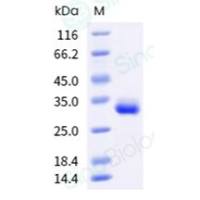 Human IgG1-Fc Protein (103 Cys/Ser) (义翘神州 10702-HNAH 现货特卖)