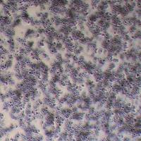 MDA-MB-453-FLUC-puro人乳腺癌细胞(FLUC标记)