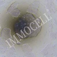 hESC（H9）人胚胎干细胞（STR鉴定正确）