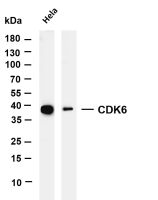 CDK6 (PT0069R) Rabbit mAb