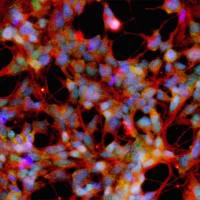 hPSC来源中脑多巴胺神经元细胞imDA-H1