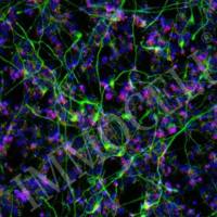 hPSC来源运动神经元细胞iMN-H1