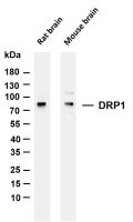 DRP1 (PT0086R) PT® Rabbit mAb