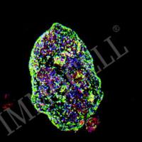 hPSC来源神经干/祖细胞iNSPC-H1