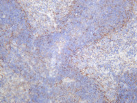 CD86 (PT0048R) PT® Rabbit mAb