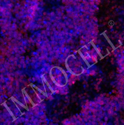 hPSC来源运动神经元祖细胞iMNP-H1