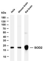 SOD2 (PT0085R) PT® Rabbit mAb