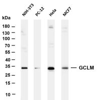 MMP7 (PT0477R) PT® Rabbit mAb
