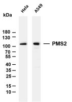 PMS2 (PT0045R) PT® Rabbit mAb