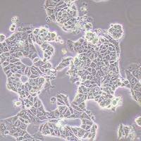 MCF-7-GFP-puro人乳腺癌细胞-GFP标记-puro抗性
