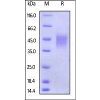 Human Fc gamma RIIIB / CD16b (NA2) Protein