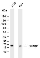 Survivin (PT0343R) PT® Rabbit mAb