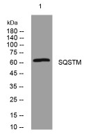 SQSTM1/p62 (PT0051R) PT® Rabbit mAb